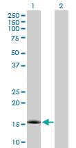 Anti-NXT1 Mouse Polyclonal Antibody