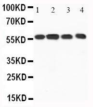 Anti-CaMKK Rabbit Polyclonal Antibody