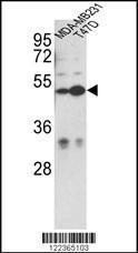 Anti-CEP55 Rabbit polyclonal antibody