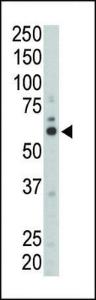 Anti-FYN Rabbit Polyclonal Antibody (PE (Phycoerythrin))