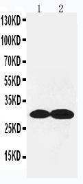 Anti-Collagen IV Rabbit Polyclonal Antibody