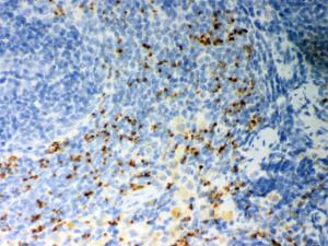 Anti-CD36 Rabbit Polyclonal Antibody