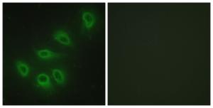 Immunofluorescence analysis of HeLa cells using Anti-eNOS Antibody. The right hand panel represents a negative control, where the antibody was pre-incubated with the immunising peptide