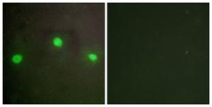 Immunofluorescence analysis of A549 cells using Anti-ATRX Antibody. The right hand panel represents a negative control, where the Antibody was pre-incubated with the immunising peptide