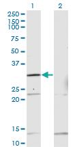 Anti-HOXB1 Mouse Monoclonal Antibody [clone: 2E5]