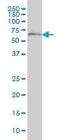 Anti-OXSR1 Mouse Monoclonal Antibody [clone: 2A2-1A2]