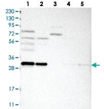 Anti-GEMIN8 Rabbit Polyclonal Antibody