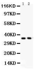 Anti-FRZB Rabbit Polyclonal Antibody