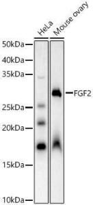 Western blot analysis of extracts of various cell lines, using Anti-FGF2 Antibody (A92780) at 1:2,000 dilution