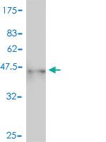 Anti-CD247 Mouse Polyclonal Antibody