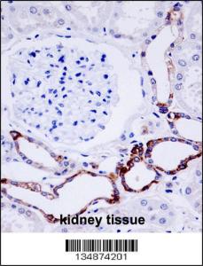 Anti-OTU7B Rabbit Polyclonal Antibody (Biotin)