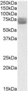 Anti-TPP1 Antibody (A84708) (0.3µg/ml) staining of Human Placenta lysate (35µg protein in RIPA buffer) with (B) and without (A) blocking with the immunising peptide. Primary incubation was 1 hour. Detected by chemiluminescence.