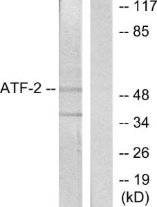 Western blot analysis of lysates from HeLa cells using Anti-ATF2 Antibody. The right hand lane represents a negative control, where the antibody is blocked by the immunising peptide.