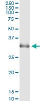 Anti-HOXB1 Mouse Monoclonal Antibody [clone: 2E5]