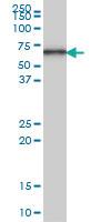 Anti-AKT3 Mouse Monoclonal Antibody [clone: 4C1]