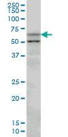 Anti-SLC33A1 Mouse Monoclonal Antibody [clone: 3A4]