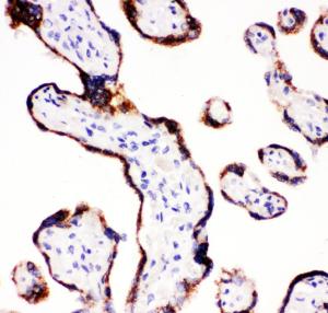 Anti-CYP11A1 Rabbit Polyclonal Antibody