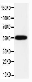 Anti-Caspase-8 (P10) Rabbit Polyclonal Antibody