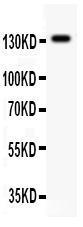 Anti-GRIN2C Rabbit Polyclonal Antibody