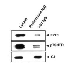 Anti-MAGEG1 Antibody