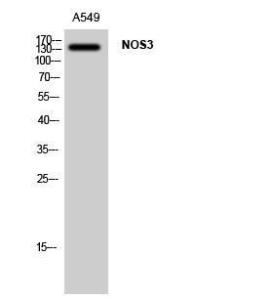 Western blot analysis of A549 cells using Anti-eNOS Antibody