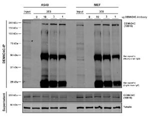 Immunoprecipitation analysis of human, mouse A549, MEF cells using Anti-DENND4C Antibody [3E8] (A304978) Three amounts of A304978 (10, 3, and 1 ug) were non-covalently coupled to 10uL of A/G sepharose beads for 1 hour at 4°C and next incubated with 250ug of A549 or MEF lysate for 2 hours at 4°C