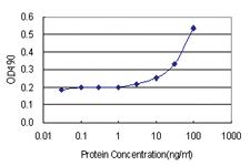 Anti-PBK Polyclonal Antibody Pair