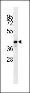 Anti-C9orf72 Rabbit Polyclonal Antibody (AP (Alkaline Phosphatase))