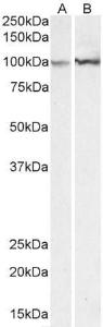 Anti-ACTN1 Antibody (A83118) (0.3 µg/ml) staining of Mouse (A) and Rat (B) Spleen lysates (35 µg protein in RIPA buffer). Primary incubation was 1 hour. Detected by chemiluminescence