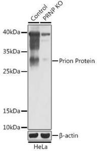 Western blot analysis of extracts from normal (control) and Prion Protein knockout (KO) HeLa cells, using Anti-Prion protein PrP Antibody (A92782) at 1:1,000 dilution. The secondary antibody was Goat Anti-Rabbit IgG H&L Antibody (HRP) at 1:10,000 dilution.