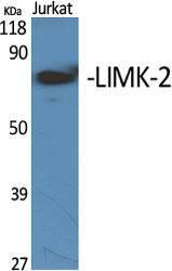 Western blot analysis of various cells using Anti-LIMK2 Antibody