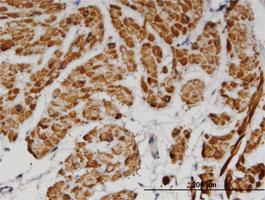 Anti-TPM2 Mouse Monoclonal Antibody [clone: 3C8]