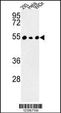 Anti-PPP1R36 Rabbit Polyclonal Antibody (Biotin)