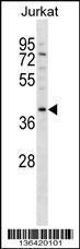 Anti-DNMT3L Rabbit Polyclonal Antibody (APC (Allophycocyanin))