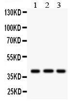 Anti-HLA-A Rabbit Polyclonal Antibody