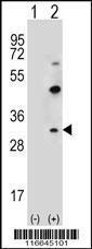 Anti-CLDN2 Rabbit Polyclonal Antibody (APC (Allophycocyanin))