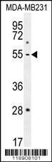 Anti-MMP1 Rabbit Polyclonal Antibody (AP (Alkaline Phosphatase))