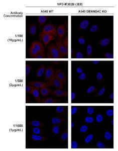 Immunocytochemistry/Immunofluorescence analysis of human A549 cells, using Anti-DENND4C Antibody [3E8] (A304978), at 1:100, 1:500, 1:1,000 for 1 hour at room temperature The secondary antibody used was Donkey anti-mouse: Alexa Fluor 594 at 1:1,000 for 1 hour at room temperature Counterstain: DAPI