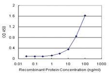 Anti-CAMKK1 Polyclonal Antibody Pair