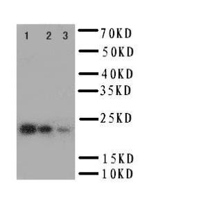 Anti-IL6 Rabbit Polyclonal Antibody