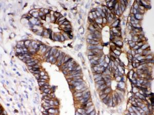 Anti-HLA-A Rabbit Polyclonal Antibody