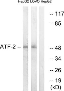 Western blot analysis of lysates from HepG2 and LOVO cells using Anti-ATF2 Antibody. The right hand lane represents a negative control, where the Antibody is blocked by the immunising peptide