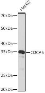 Western blot analysis of extracts of HepG2 cells, using Anti-CDCA5 Antibody [ARC2096] (A306109) at 1:1,000 dilution. The secondary antibody was Goat Anti-Rabbit IgG H&L Antibody (HRP) at 1:10,000 dilution.