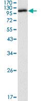 Anti-DAXX Mouse Monoclonal Antibody [clone: 7A11]