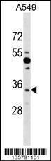 Anti-BOLL Rabbit Polyclonal Antibody (FITC (Fluorescein Isothiocyanate))