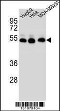 Anti-TUBB2B Rabbit Polyclonal Antibody (FITC (Fluorescein Isothiocyanate))