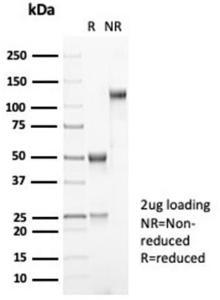 Anti-MDM2 Rabbit Recombinant Antibody [Clone: MDM2/7061R]