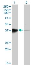 Anti-HOXB5 Mouse Monoclonal Antibody [clone: 3F10]