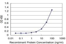 Anti-AKT3 Mouse Monoclonal Antibody [clone: 4C1]