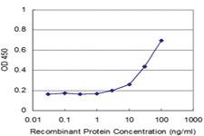 Anti-TPM2 Mouse Monoclonal Antibody [clone: 3C8]